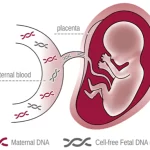 NIPT یا تست غربالگری غیر تهاجمی چیست؟